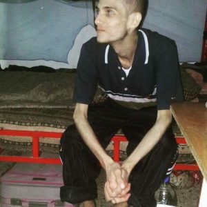 Omar, pictured at age 20, sits on a bench with his hands clasped together as he recovers from malnutrition shortly after he was smuggled out of prison in 2015.