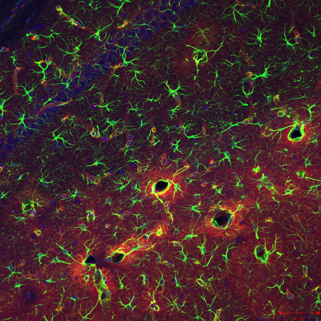 Visualization of astrocytes