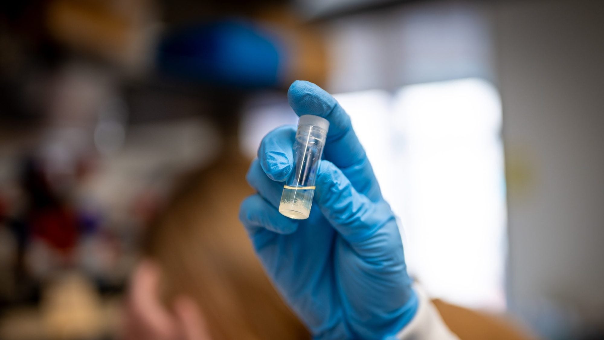 Knope examines a vial in a lab