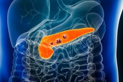 A 3D image of the inside of a human torso with the pancreas lit up in orange