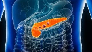 A 3D image of the inside of a human torso with the pancreas lit up in orange